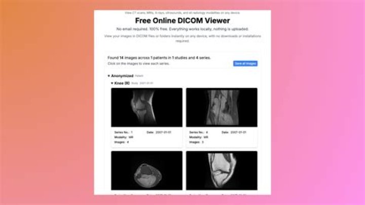 How do I open a DICOM video file?